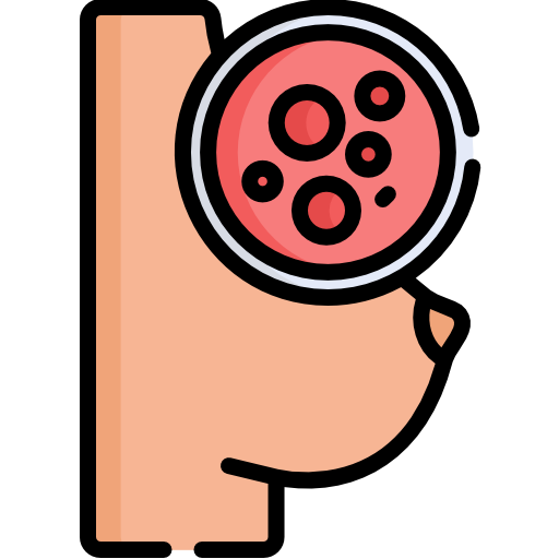 STGO - Cancer du sein